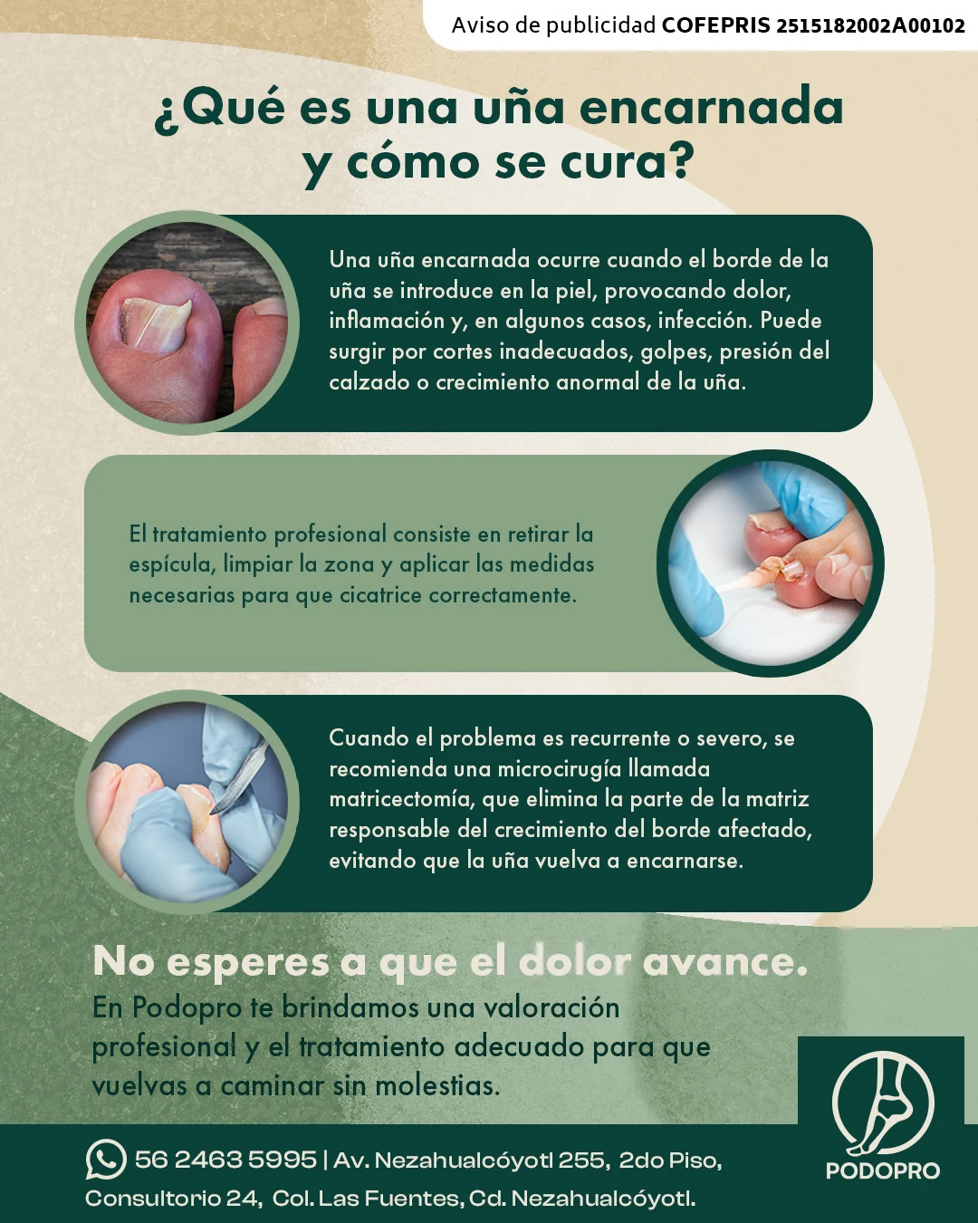 Publicación informativa de Podopro que explica qué es una uña encarnada y cómo se trata
