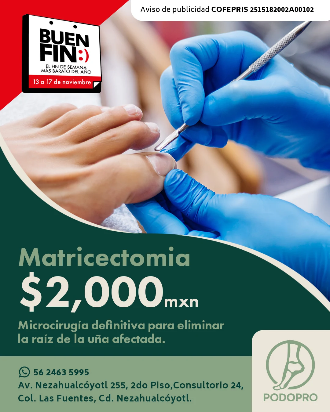 Campaña promocional de Podopro para matricectomía durante Buen Fin